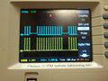 UART-Signal am STM23 und am der Lightbox am RX